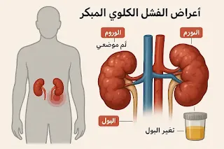 صورة توضيحية للكلى وأعراض الفشل الكلوي