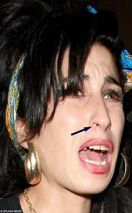 Amy Winehouse Nose What's Up Shocking Picture Of White Substance In