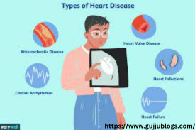 what are the types of cardiovascular?