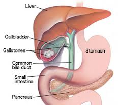 WHAT IS GALLBLADDER? CAUSES, PAIN, INFLAMMATION OF GALLBLADDER, WHAT ARE GALLSTONE?  WHAT IS MAIN  CAUSES OF  GALLSTONE? SYMPTOMS, CAN YOU LIVE WITHOUT IT? WHAT HAPPENED AFTER GALLBLADDER REMOVE? DIAGNOSIS. TREATMENT