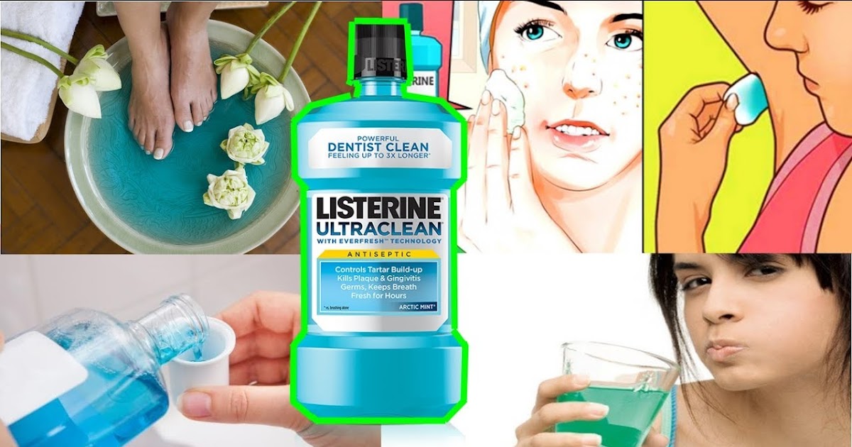 10 Cara Kegunaan Listerine Selain Sebagai Ubat Kumur 