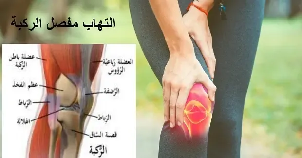 أفضل طرق للتغلب على التهاب مفصل الركبة: قائمة النصائح الحصرية لتخفيف الألم