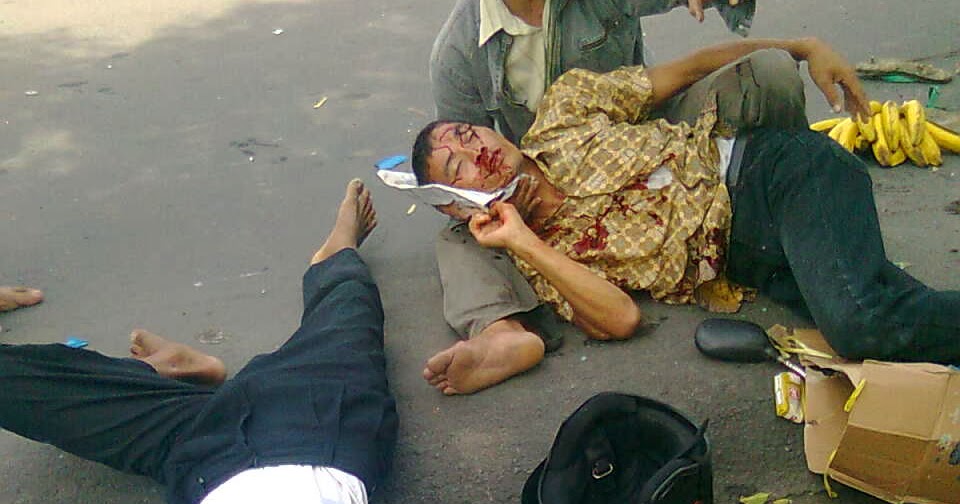 Gambar Kecelakaan