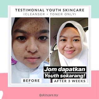 Produk Skincare Untuk Mengecilkan Liang Pori Kulit Muka Besar