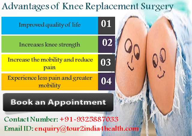 Advantages of Knee Replacement Surgery