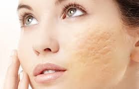 Skin Treatment in Thane    