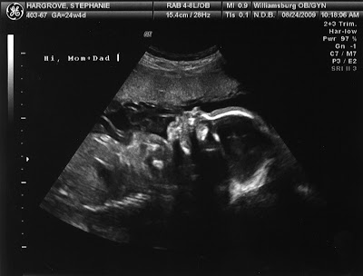 sonogram 5 weeks. 24 Week Sonogram Pictures