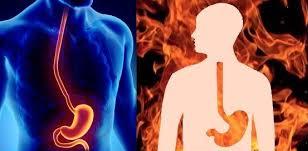 How-to-get-relief-from-heartburn