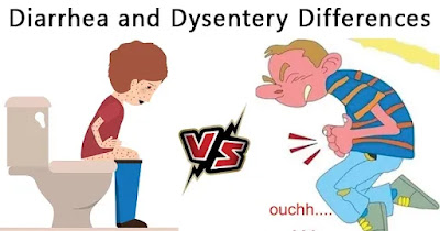 Diarrhea TreatmentDiarrhea SymptomsSimple Solutions for Everyone