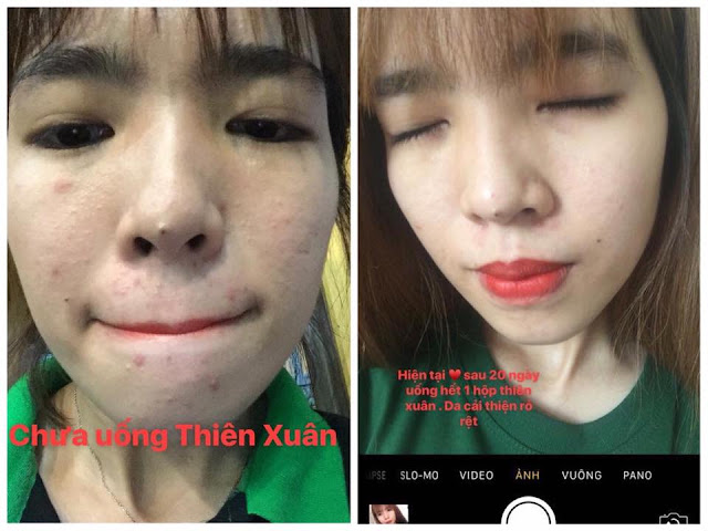 430K - Bột trắng da Thiên Xuân - thảo dược - Hoài Thương Organic