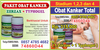 pemesanan cara mencegah kanker darah alami, kunjungi cara tuntaskan kanker payudara cermin dunia kedokteran, kontak cara pengobatan kanker payudara luka