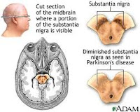 Obat Parkinson Alami