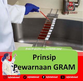 Prinsip Pewarnaan GRAM