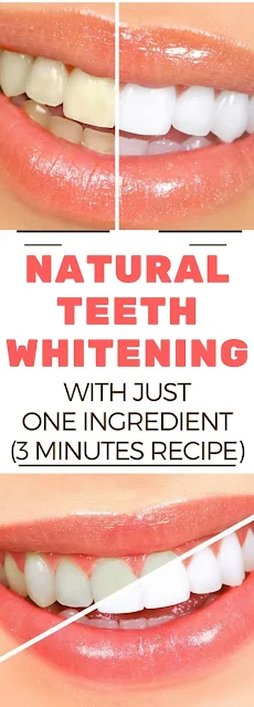 Natural Teeth Whitening With Just 1 Ingredient (3 Minute Recipe)