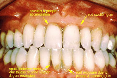 Part of Teeth