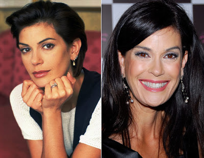 Teri Hatcher Plastic Surgery Before and After