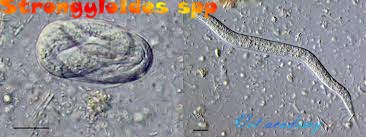 Strongyloides spp - threadworms - pinworms