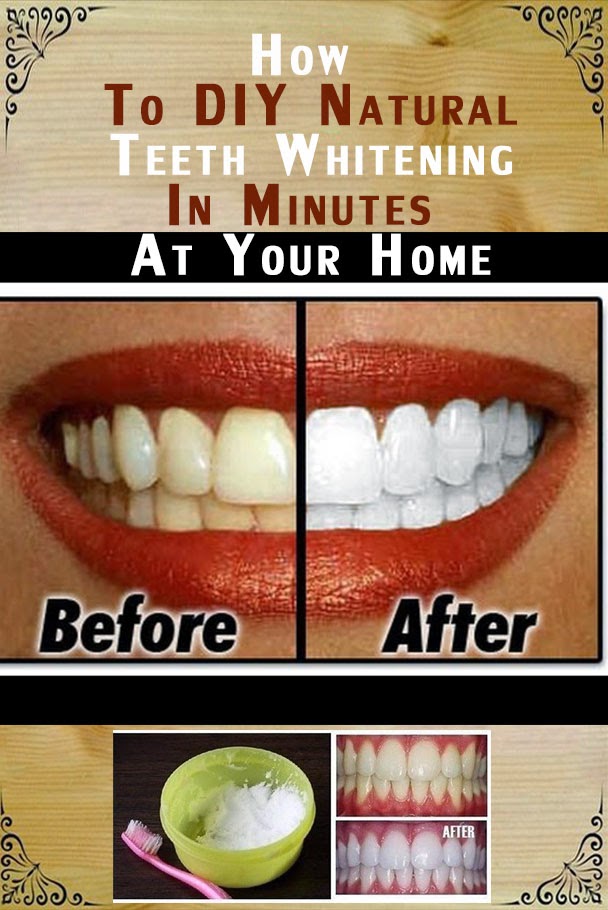 How to DIY Natural Teeth Whitening in Minutes at Your Home