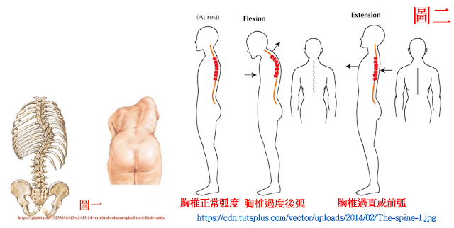 脊椎側彎, 脊椎側彎背架, 脊椎度數,脊椎側彎矯正, 脊椎側彎治療, 脊椎側彎 復健