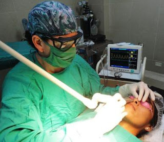 rinoplastia, rinoplastia laser, especialista en rinoplastia, dr guanilo