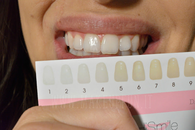 Whiten Your Teeth In 10 Minutes With HiSmile