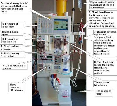 Dialysis gadolinium home kidney dialysis