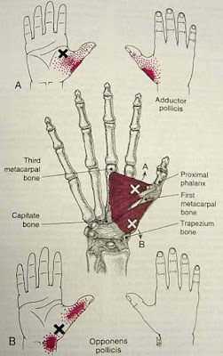 MIOTERAPIA