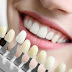 Răng sứ bị đổi màu nên làm gì để khắc phục?
