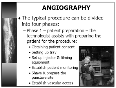 Angiography (or Arteriography)