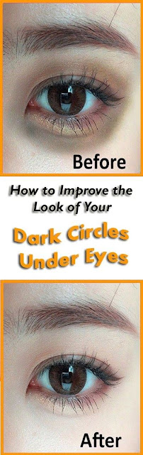 How to Improve the look of your Dark circles Under Eyes