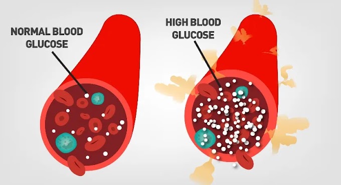 BLOOD SUGAR