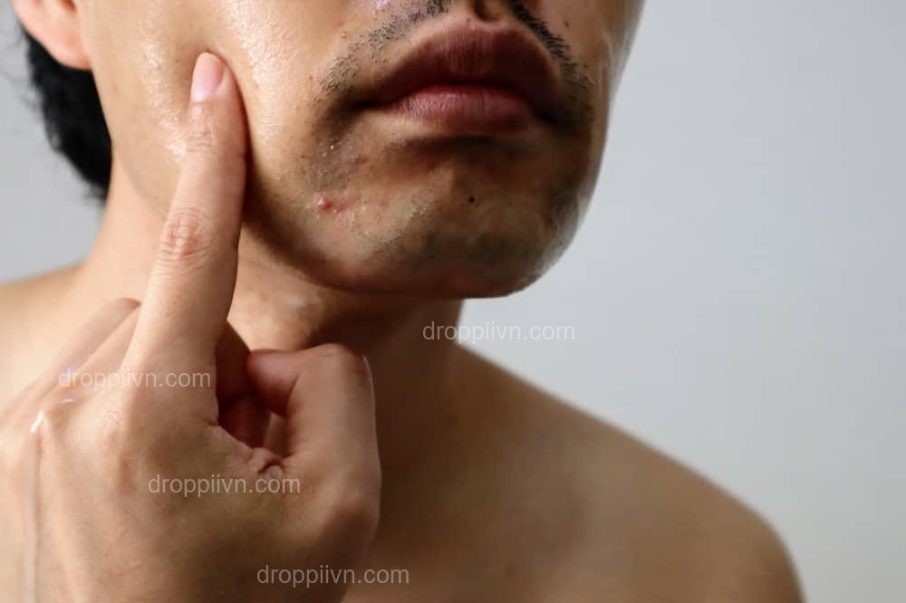 You may be looking at a problem from a few different perspectives, like a skin Infection, Redness, or Harvard University Testis