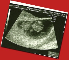 Baby 2 @ 9.5 weeks