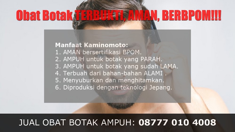 CARA PENUMBUH RAMBUT ALAMI CEPAT<br/>Kepulauan Yapen<br/>