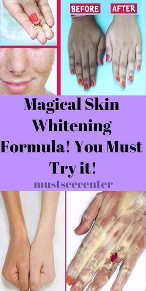 MAGICAL SKIN WHITENING FORMULA! YOU MUST TRY IT!