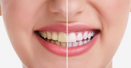 Kesehatan Gigi dan Mulut