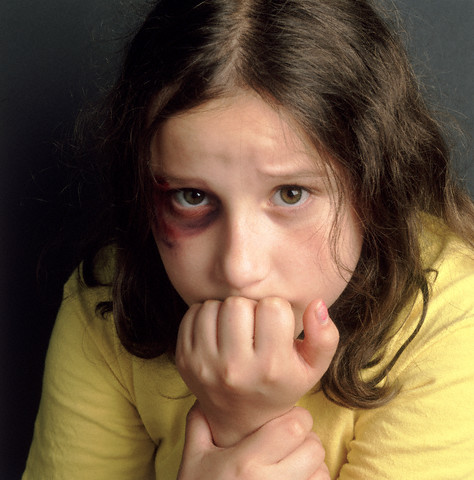 professionals have seen a child they suspect was being physically abused