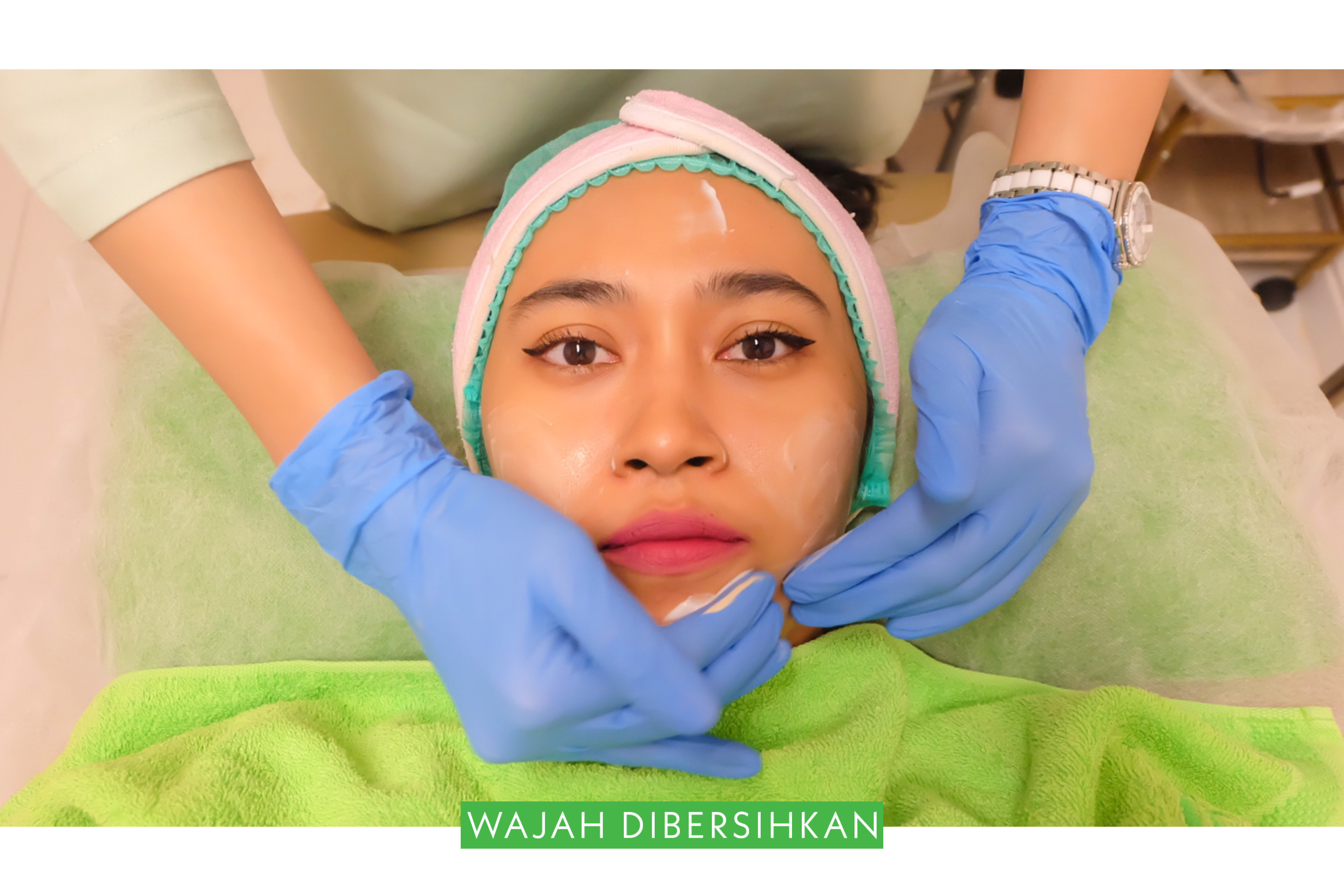 [Review] Treatment DNA Salmon Micro Injection di ZAP Clinic