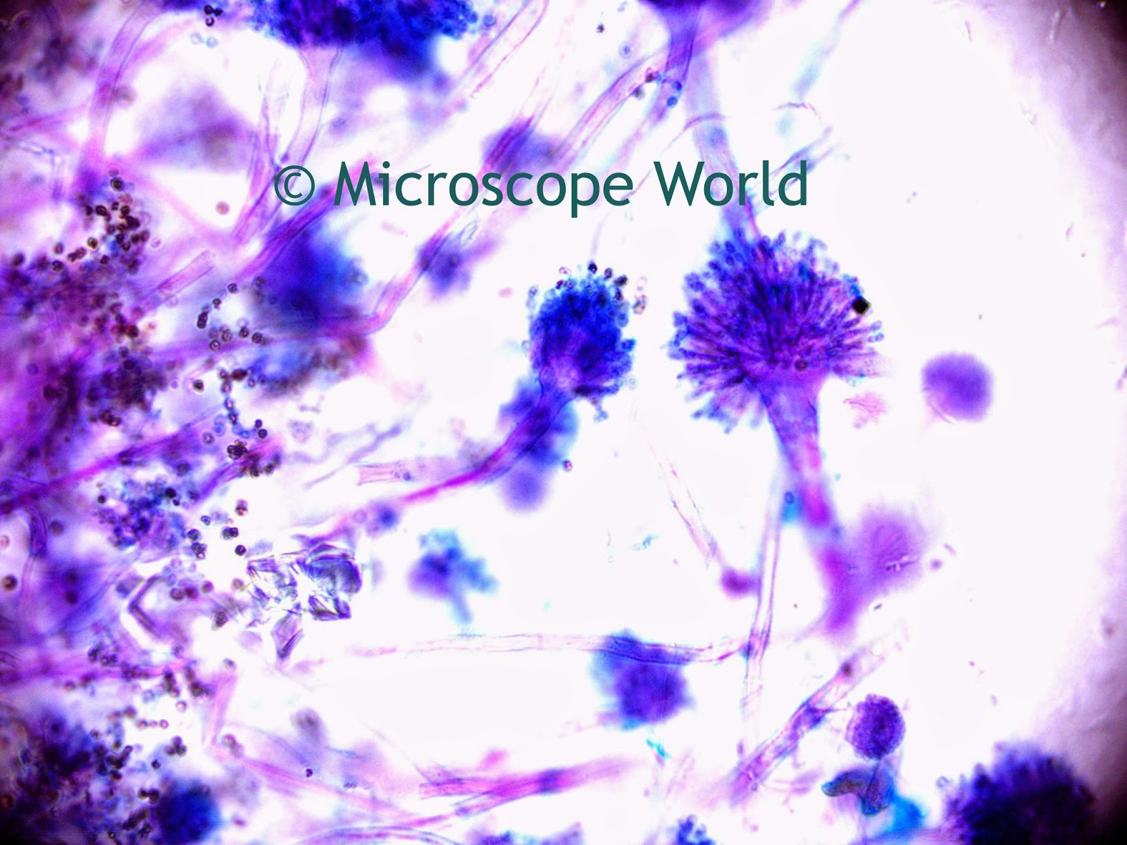 Microscope World Blog: Science Project: Mold under the ...