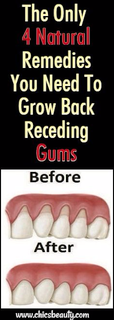 The Only 4 Natural Remedies You Need To Grow Back Receding Gums