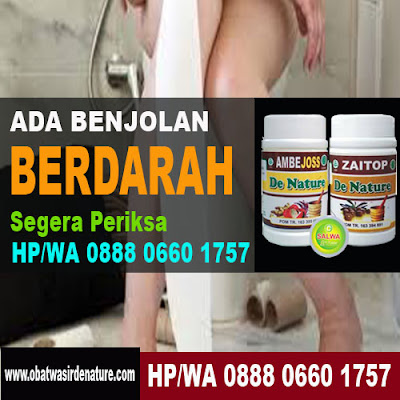 OBAT WASIR BERDARAH