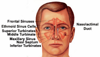 Faktor Penyebab Penyakit Sinusitis