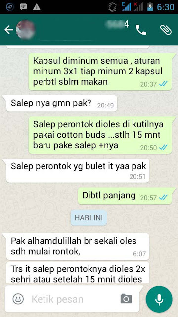 Cara Merontokan Kutil Tanpa Operai pake Obat Herbal