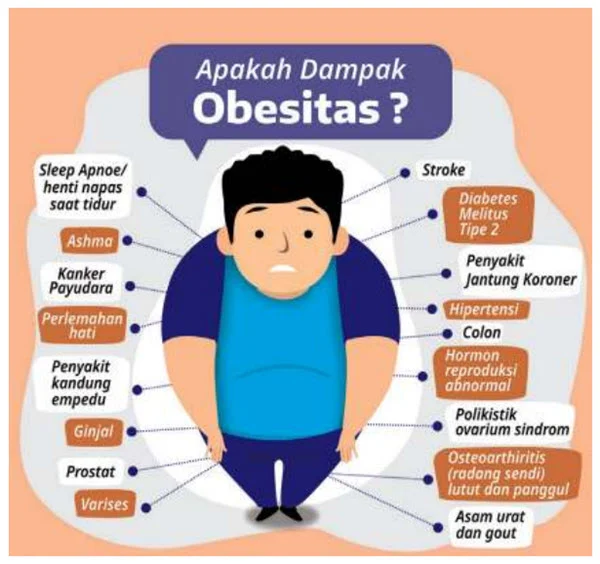 Obesitas