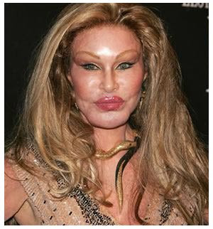 Jocelyn  Wildenstein Bad Rhinoplasty