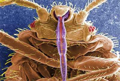 bed bug picture under microscope