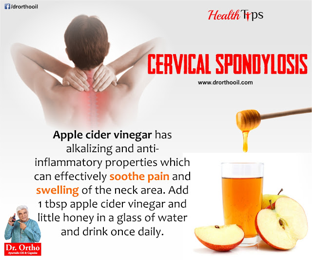 Health Tips for Cervical Spondylosis