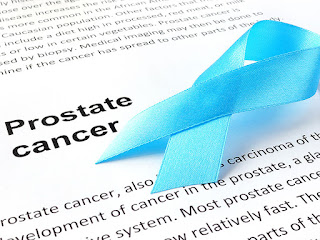 Prostate Cancer And The Treatment You Need To Know