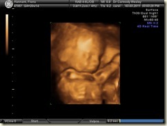 BABY_4