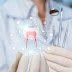 What Are The Instructions To Follow Before Going Dental Implant Treatment?